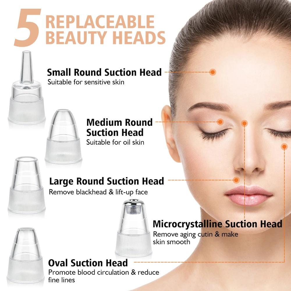 Electric Blackhead Remover - May and Olive