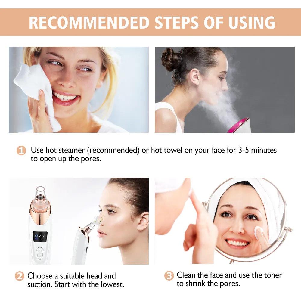 Electric Blackhead Remover - May and Olive