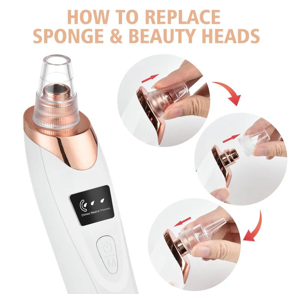 Electric Blackhead Remover - May and Olive